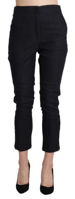 Ermanno Scervino: Короткие брюки 
