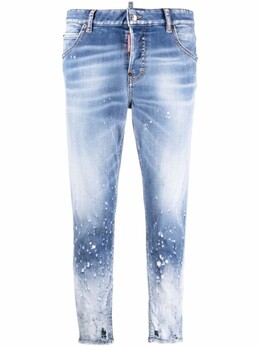 Dsquared2: Короткие джинсы 